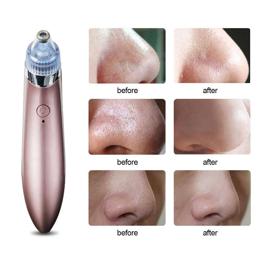 Blackhead Remover Face Deep Nose Cleaner T Zone Pore Acne Pimple Removal Vacuum Suction Facial Diamond Beauty Clean Skin Tool